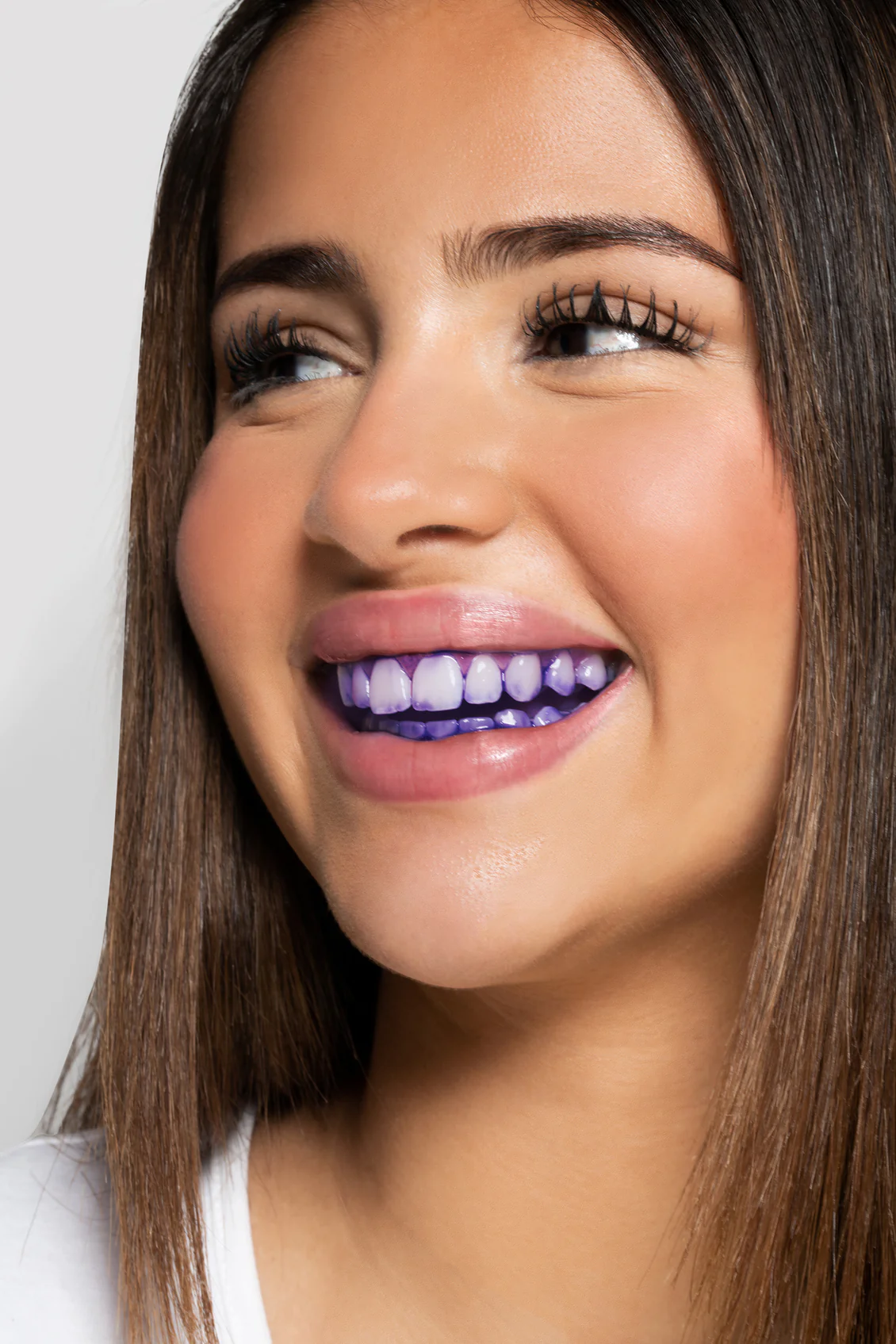 Is tanden bleken slecht voor je? 🦷 — Clearsmile
